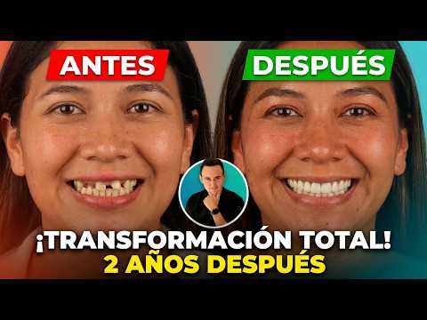 Maria's Life-Changing Dental Transformation