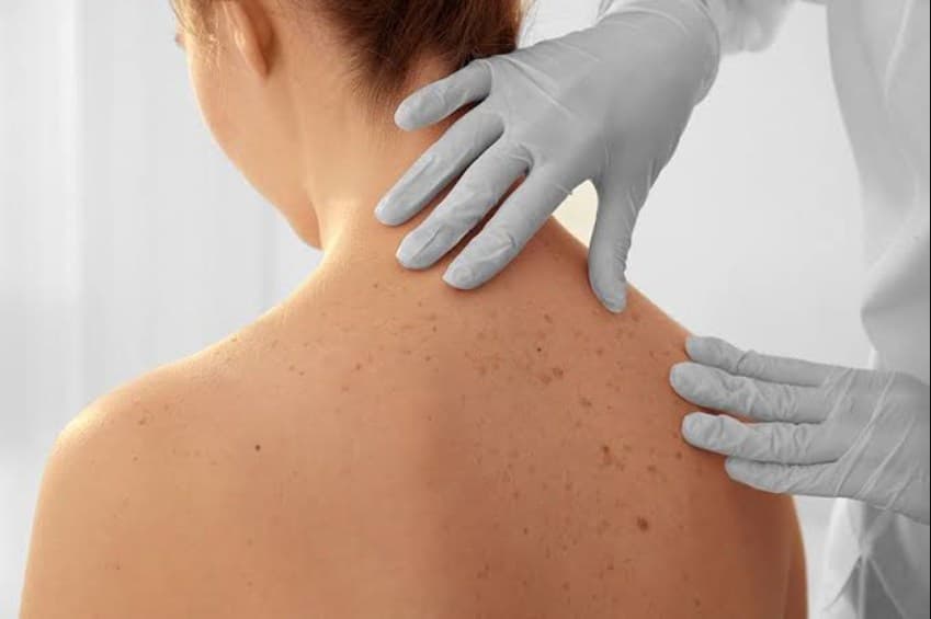 Dermatología/Medicina Capilar